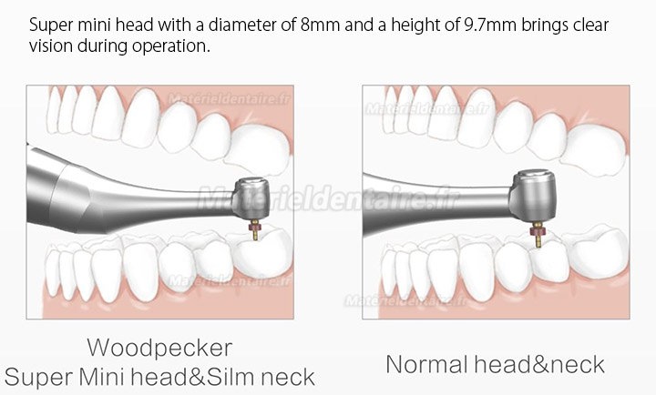 Woodpecker MotoPex brushless moteur d’endodontie dentaire (localisateur apex intégré)